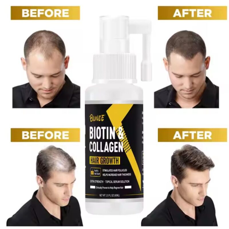 Biotin & Collagen Hair Growht in Pakistan